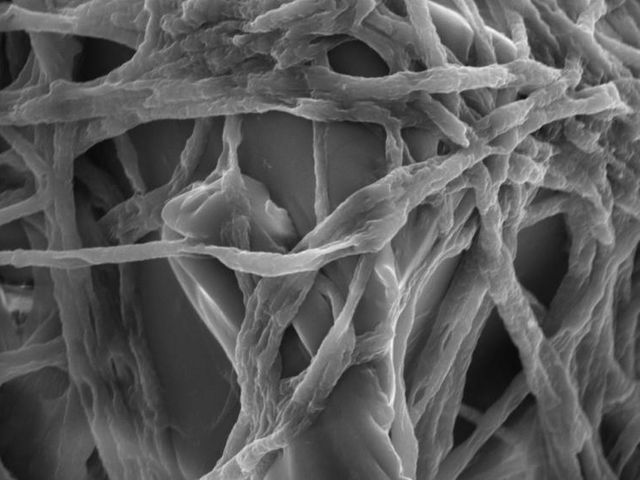 Fusarium mycelia colonise a plastic particle, eElectron microscope image. | Image: Sabreen Samuel Ibrahim Dawoud