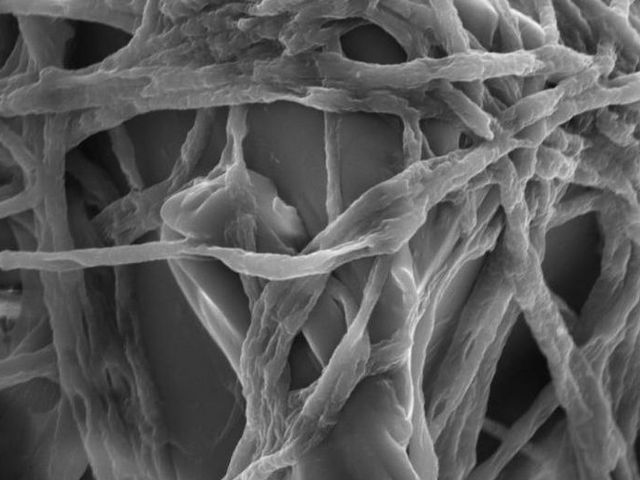 Pilzmyzelien von Fusarium besiedeln einen Kunststoffpartikel, elektronenmikroskopische Aufnahme. | Bild: Sabreen Samuel Ibrahim Dawoud